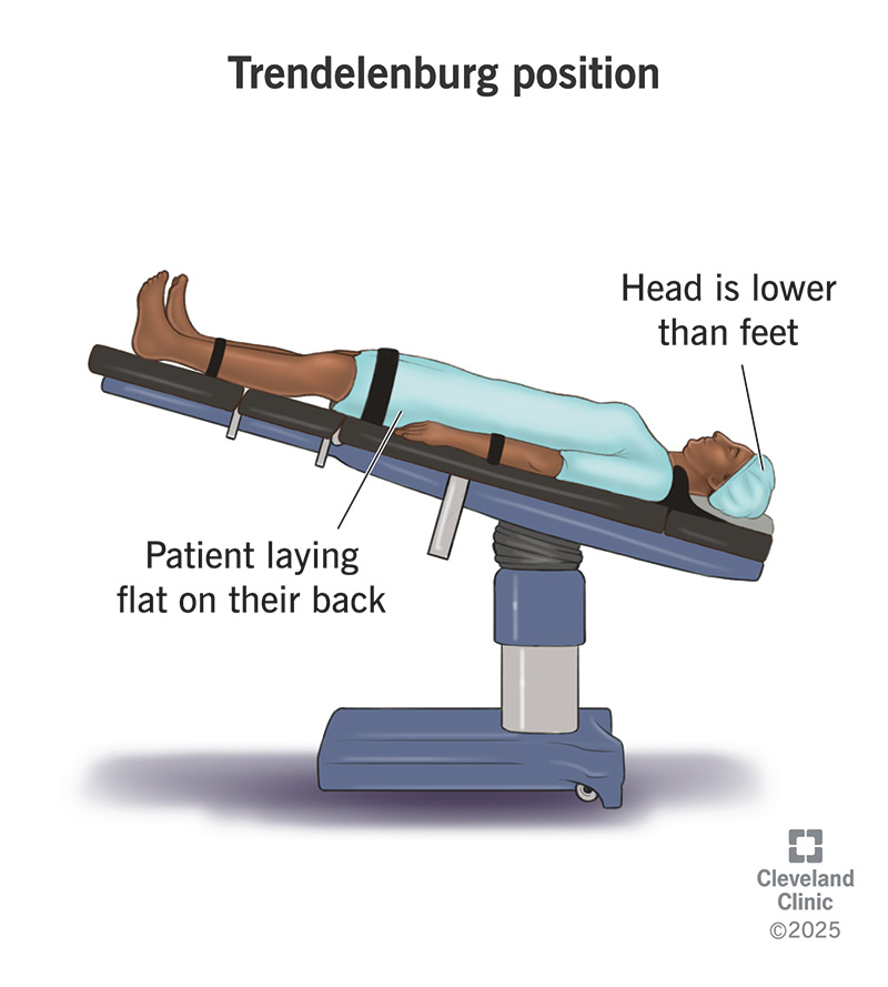 When Putting Your Head between Legs What Prevents Injuries